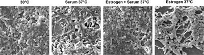 Exploring the effect of estrogen on Candida albicans hyphal cell wall glycans and ergosterol synthesis